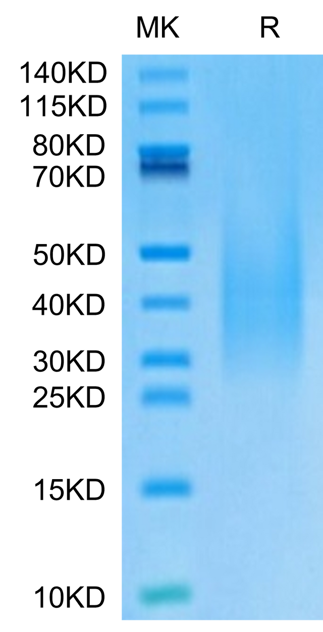 Monkeypox virus A30 on Tris-Bis PAGE under reduced condition. The purity is greater than 95%.