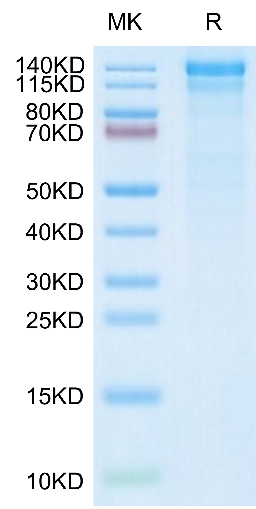 Human ITGA10&ITGB1 on Tris-Bis PAGE under reduced condition. The purity is greater than 90%.