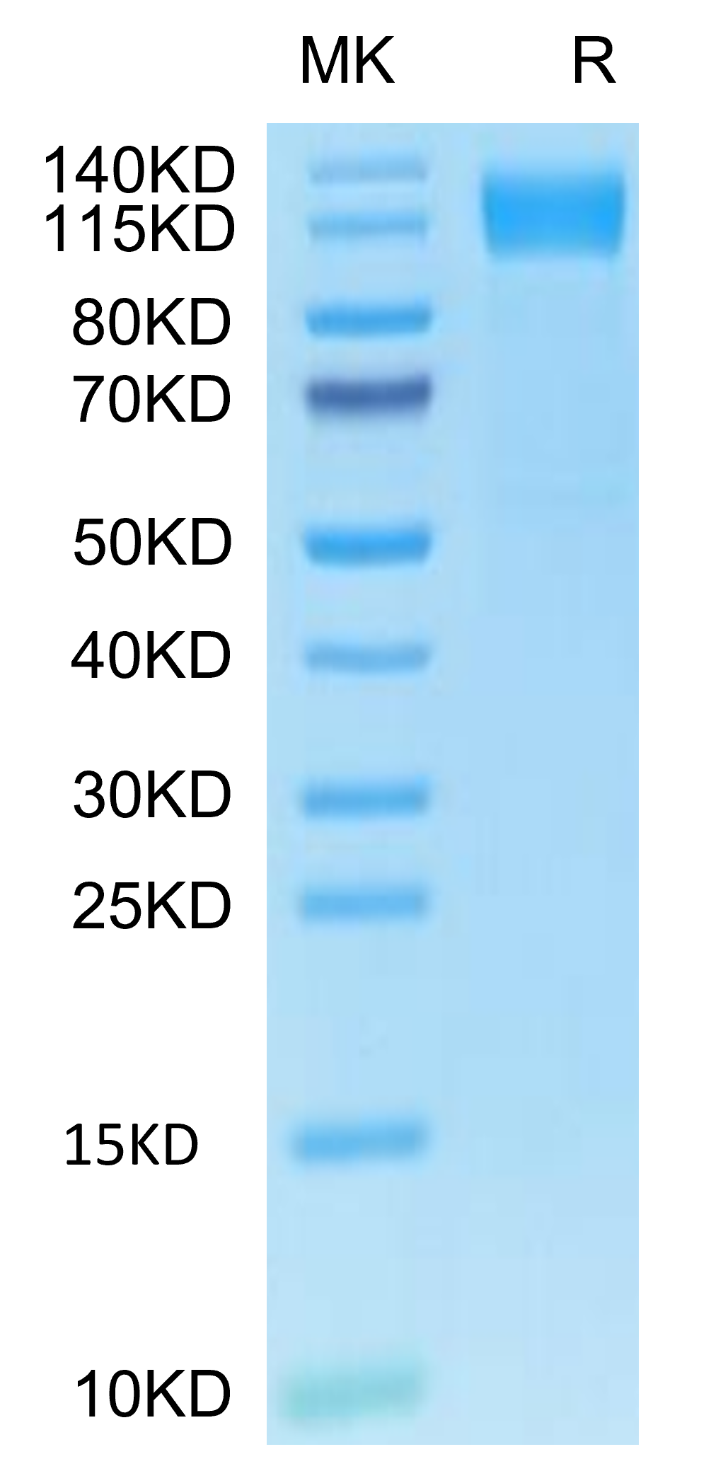 Human OSMR&GP130 on Tris-Bis PAGE under reduced condition. The purity is greater than 95%.