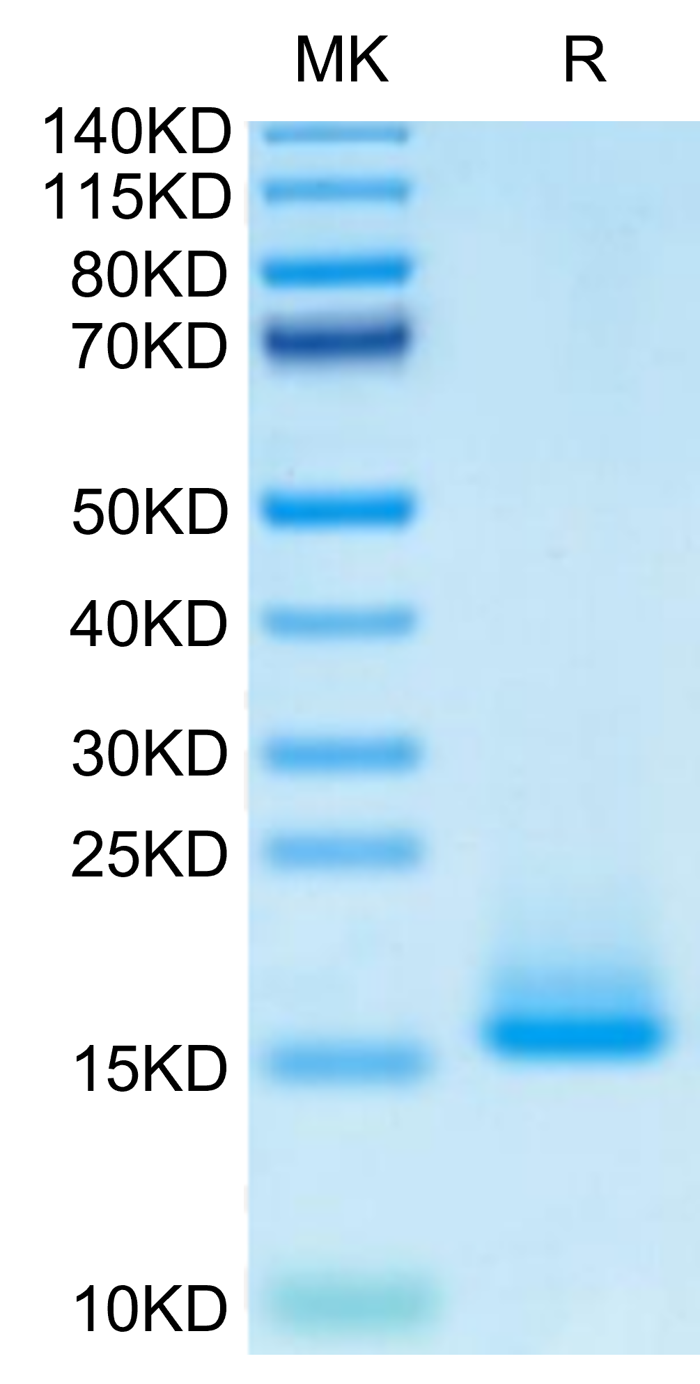 Monkeypox virus A35R on Tris-Bis PAGE under reduced condition. The purity is greater than 95%.