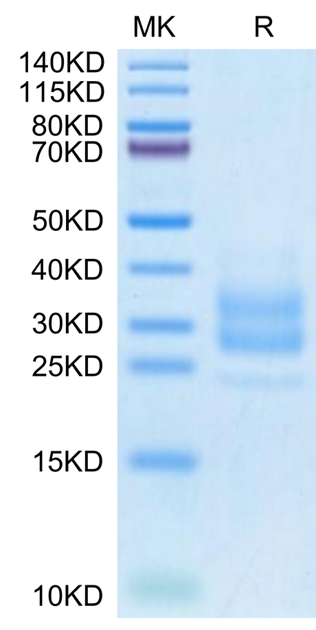 Monkeypox virus M1R on Tris-Bis PAGE under reduced condition. The purity is greater than 95%.