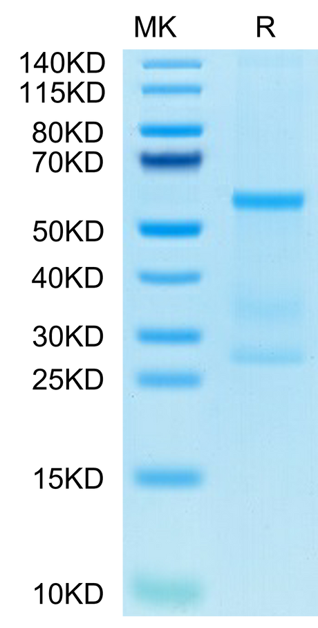 Human IL-27 on Tris-Bis PAGE under reduced condition. The purity is greater than 95%.