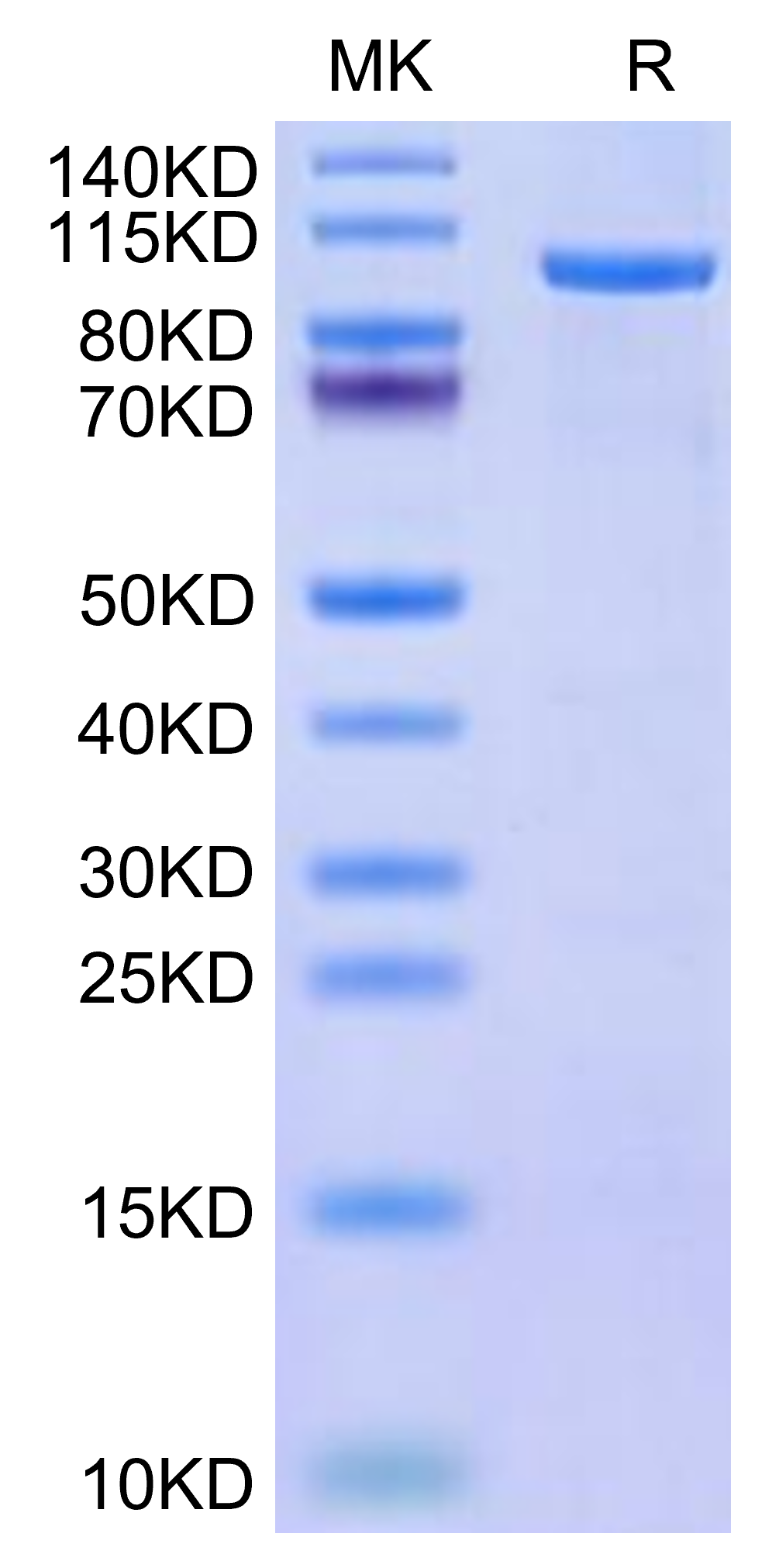 Human CDH19 on Tris-Bis PAGE under reduced condition. The purity is greater than 95%.