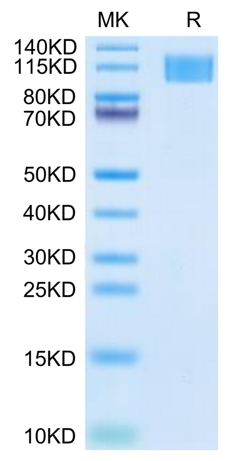 Human Aggrecan on Tris-Bis PAGE under reduced condition. The purity is greater than 95%.
