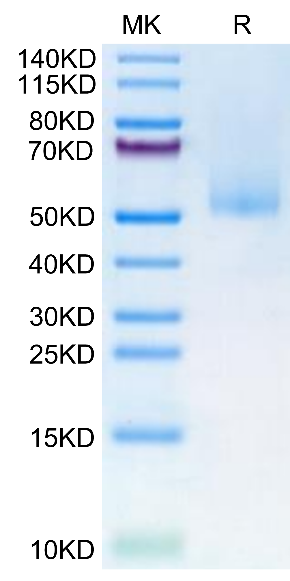 Human MICA alpha 3 on Tris-Bis PAGE under reduced condition. The purity is greater than 95%.