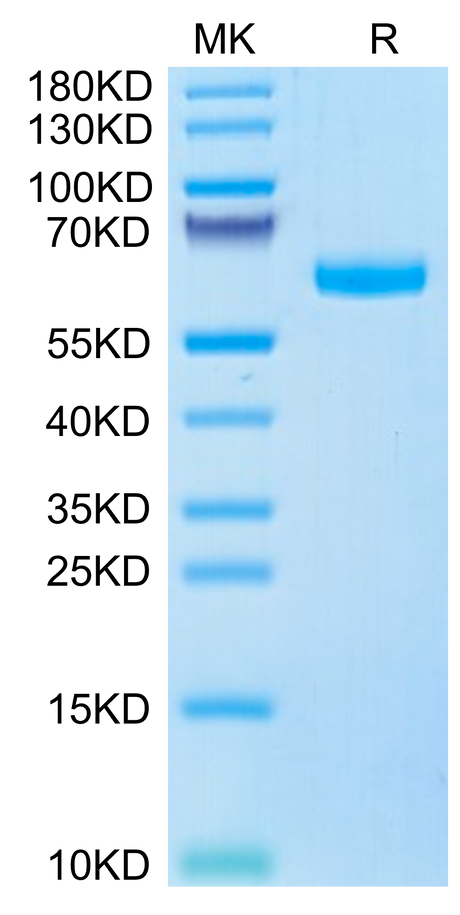 Human ULBP-6 on Tris-Bis PAGE under reduced condition. The purity is greater than 95%.