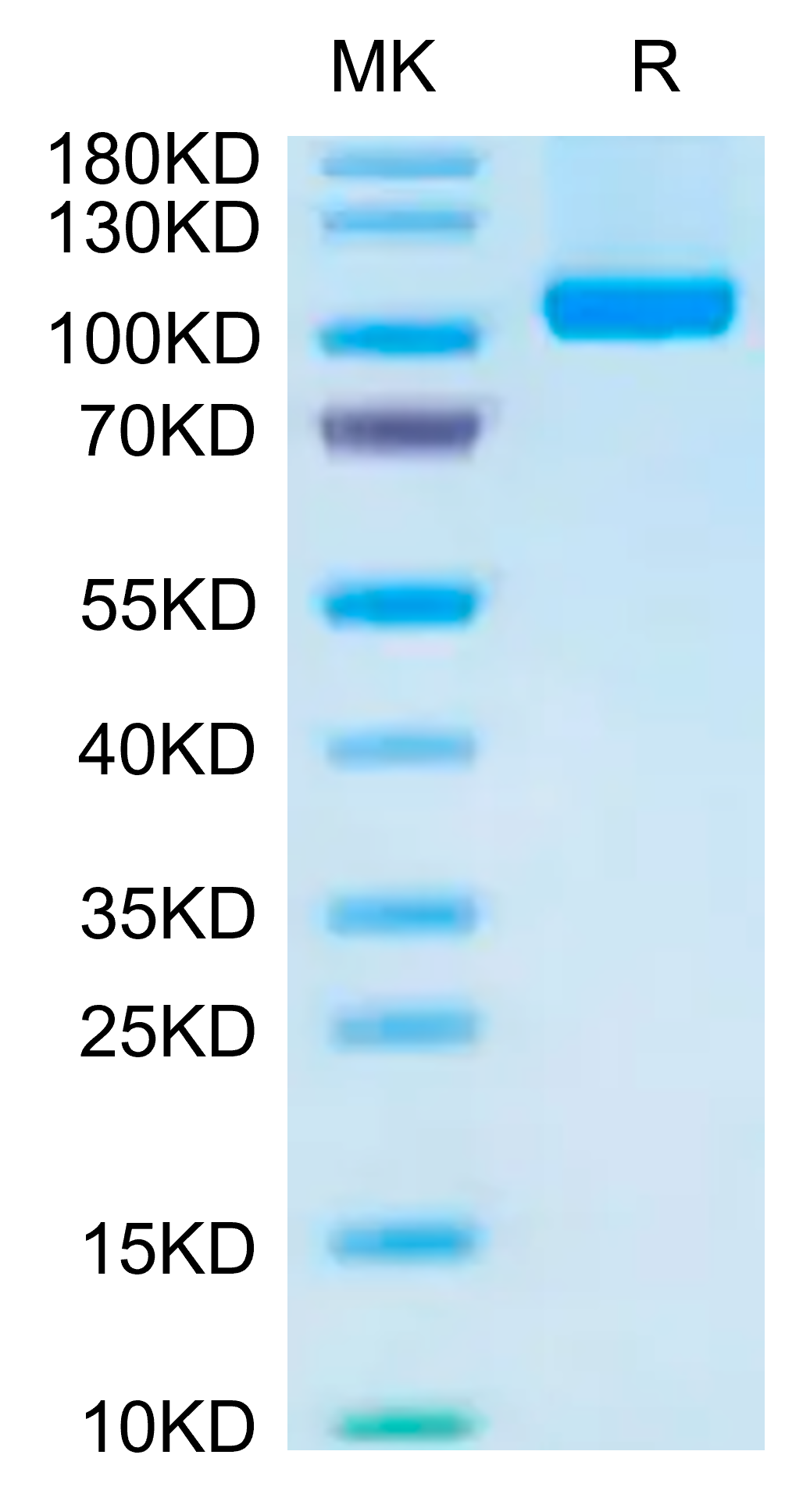 Human VAP-1 on Tris-Bis PAGE under reduced condition. The purity is greater than 95%.