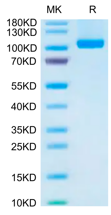 Human VAP-1 on Tris-Bis PAGE under reduced condition. The purity is greater than 95%.