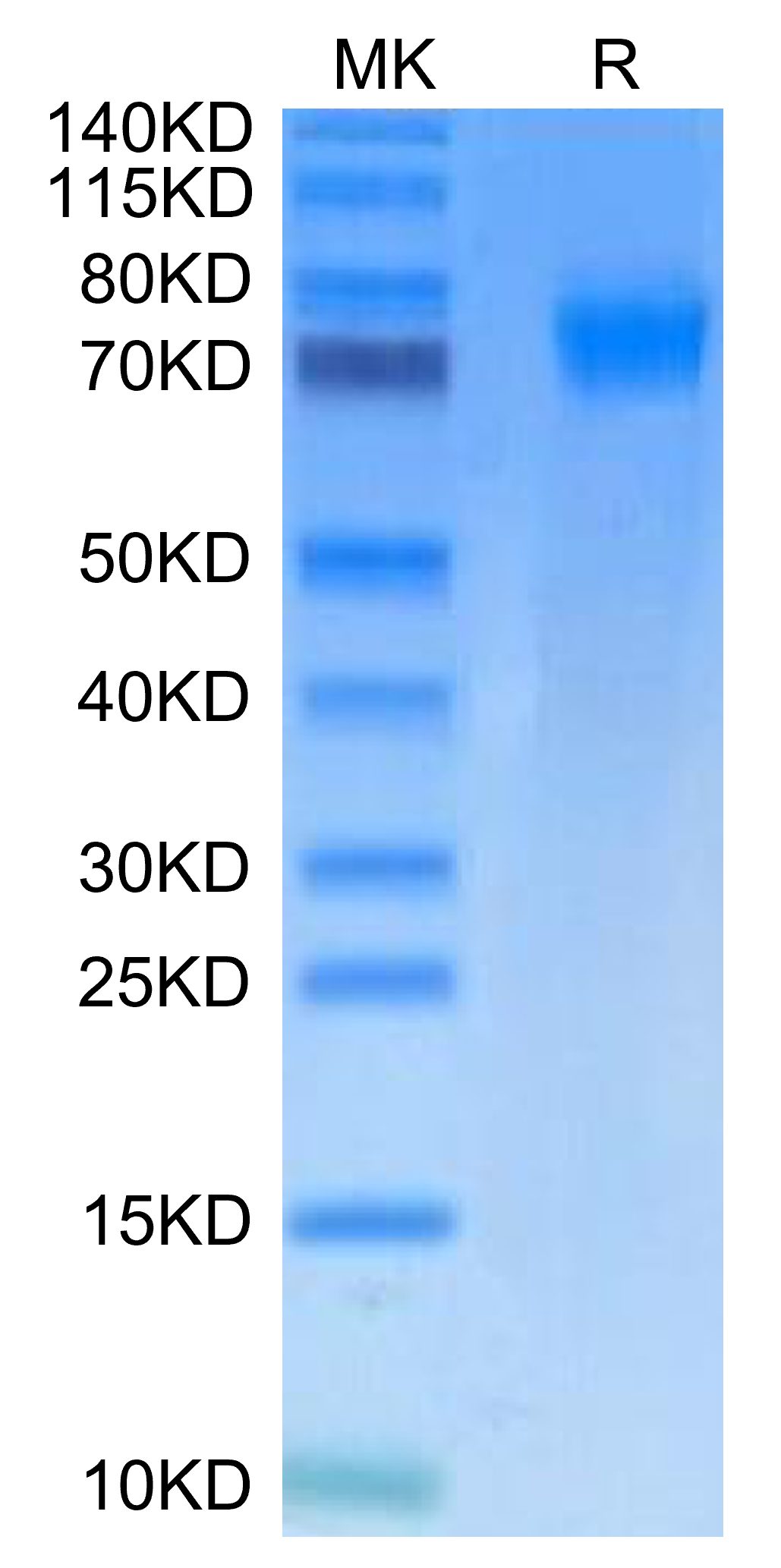 Mouse PDGF R alpha on Tris-Bis PAGE under reduced condition. The purity is greater than 95%.