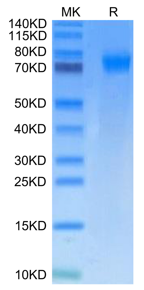 Mouse PDGF R alpha on Tris-Bis PAGE under reduced condition. The purity is greater than 95%.