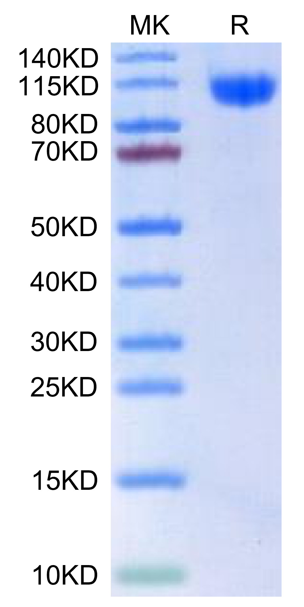 Human RET-on Tris-Bis PAGE under reduced condition. The purity is greater than 95%.