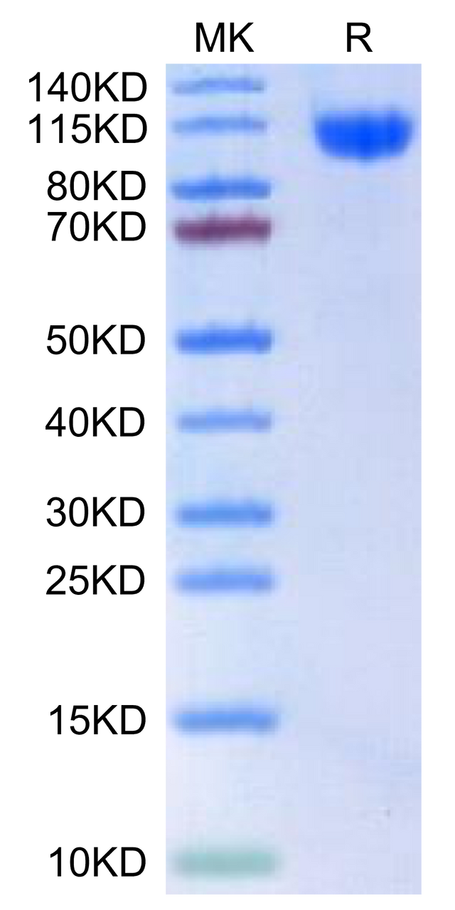 Human RET-on Tris-Bis PAGE under reduced condition. The purity is greater than 95%.