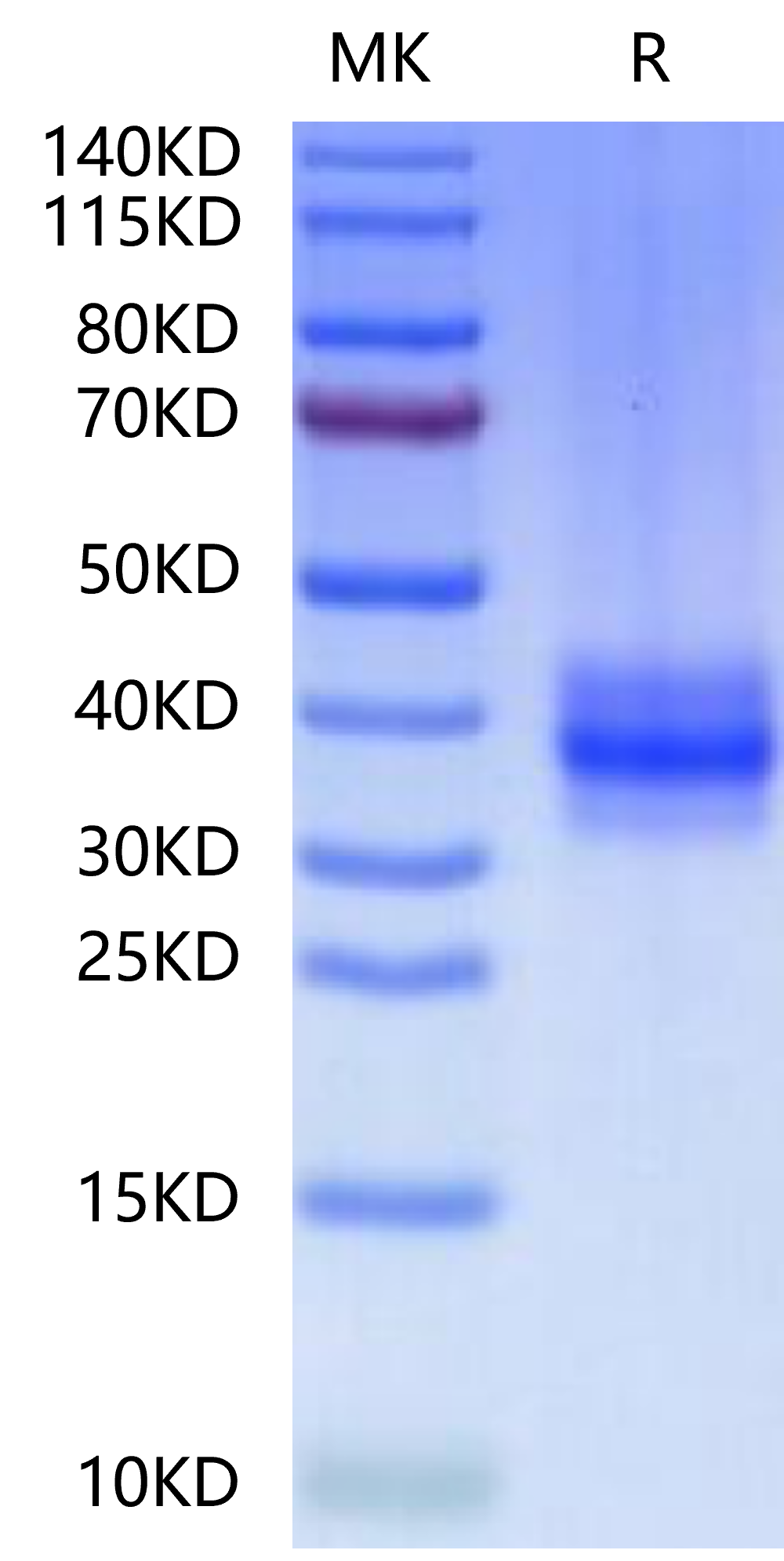 Human FOLR3 on Tris-Bis PAGE under reduced condition. The purity is greater than 95%.