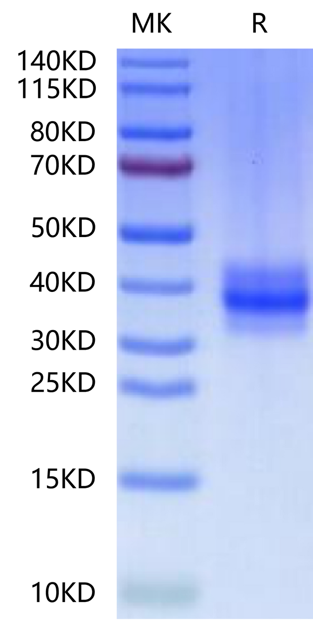 Human FOLR3 on Tris-Bis PAGE under reduced condition. The purity is greater than 95%.
