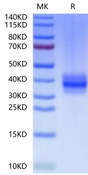 Human FOLR3 on Tris-Bis PAGE under reduced condition. The purity is greater than 95%.