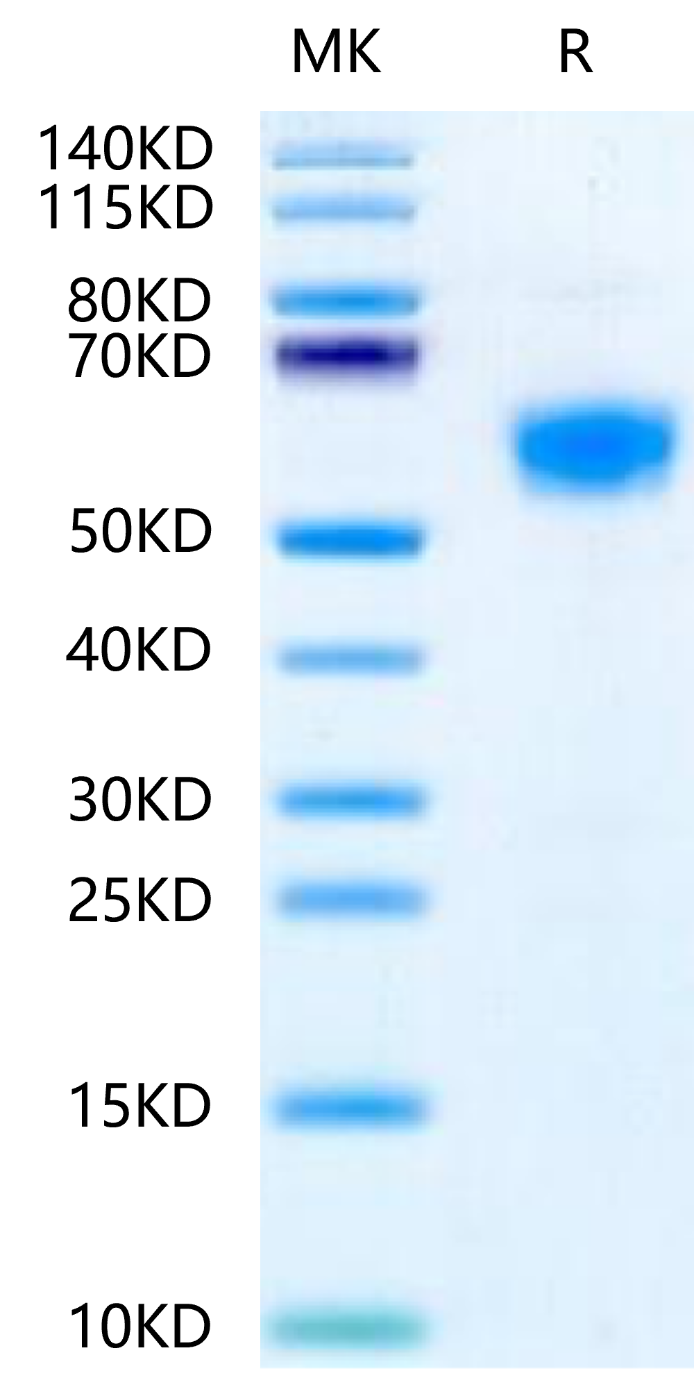 Mouse IL-18RAP on Tris-Bis PAGE under reduced condition. The purity is greater than 95%.