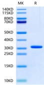 Human UBASH3B on Tris-Bis PAGE under reduced condition. The purity is greater than 95%.