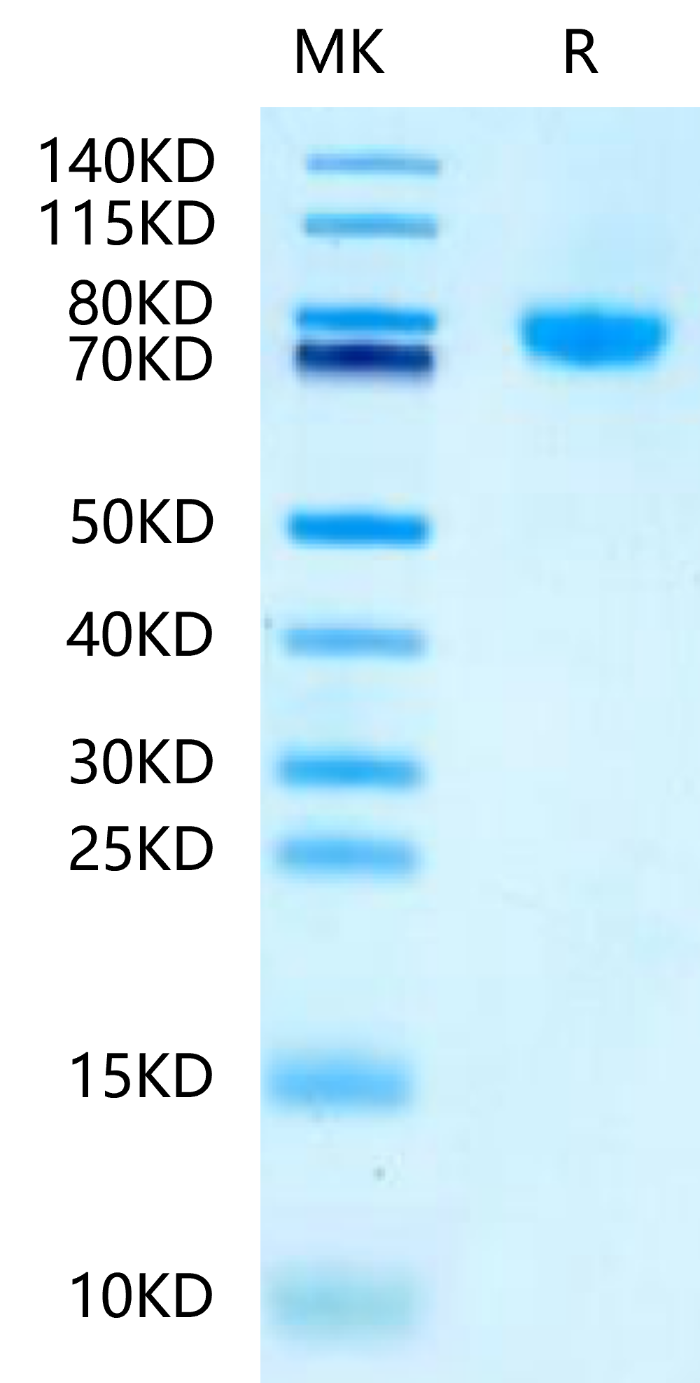 Mouse LRRC15 on Tris-Bis PAGE under reduced condition. The purity is greater than 95%.