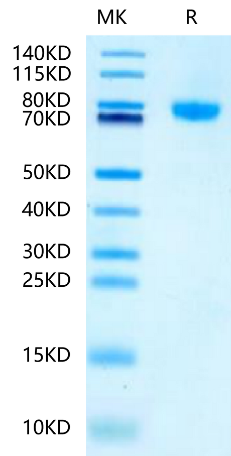 Mouse LRRC15 on Tris-Bis PAGE under reduced condition. The purity is greater than 95%.