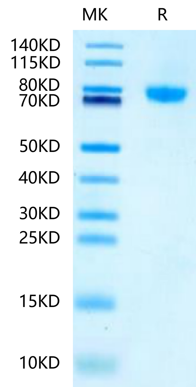 Mouse LRRC15 on Tris-Bis PAGE under reduced condition. The purity is greater than 95%.
