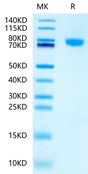 Mouse LRRC15 on Tris-Bis PAGE under reduced condition. The purity is greater than 95%.