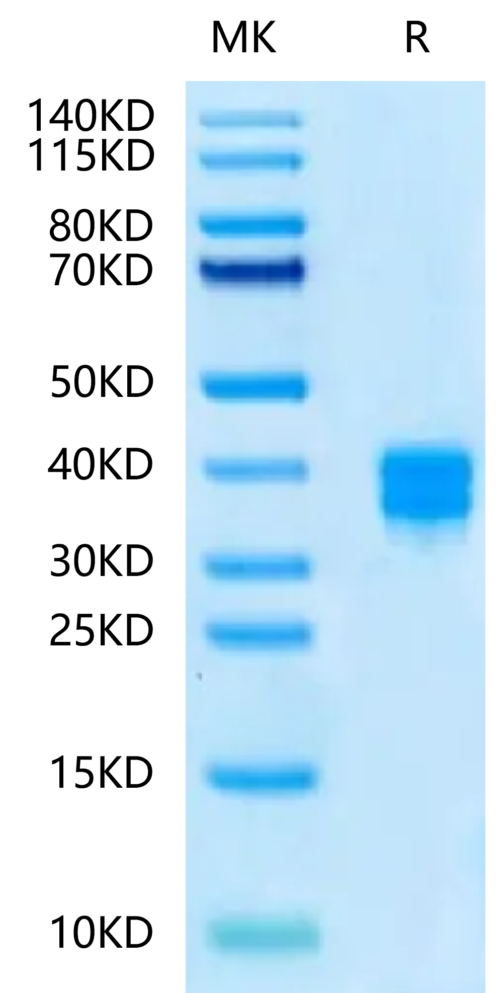 Human CD8 alpha&beta Heterodimer on Tris-Bis PAGE under reduced condition. The purity is greater than 95%.