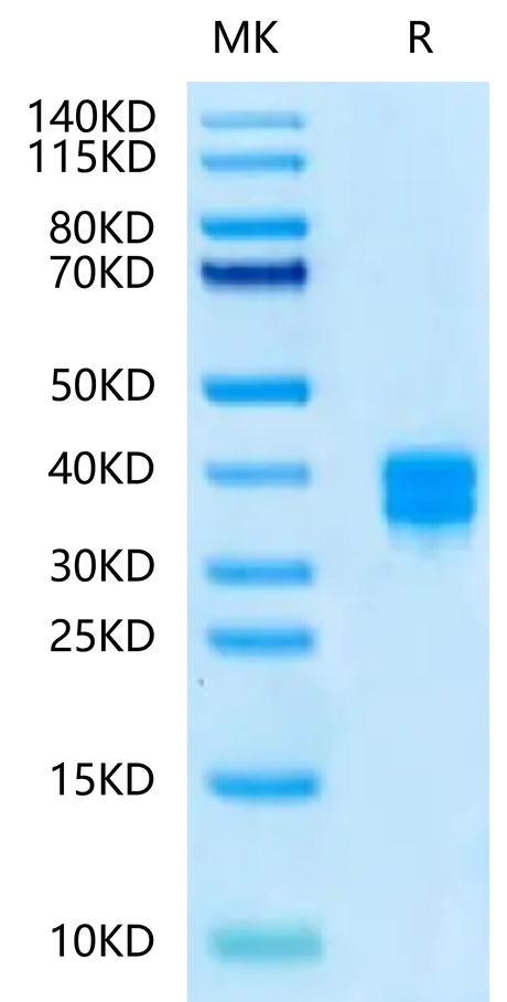 Human CD8 alpha&beta Heterodimer on Tris-Bis PAGE under reduced condition. The purity is greater than 95%.