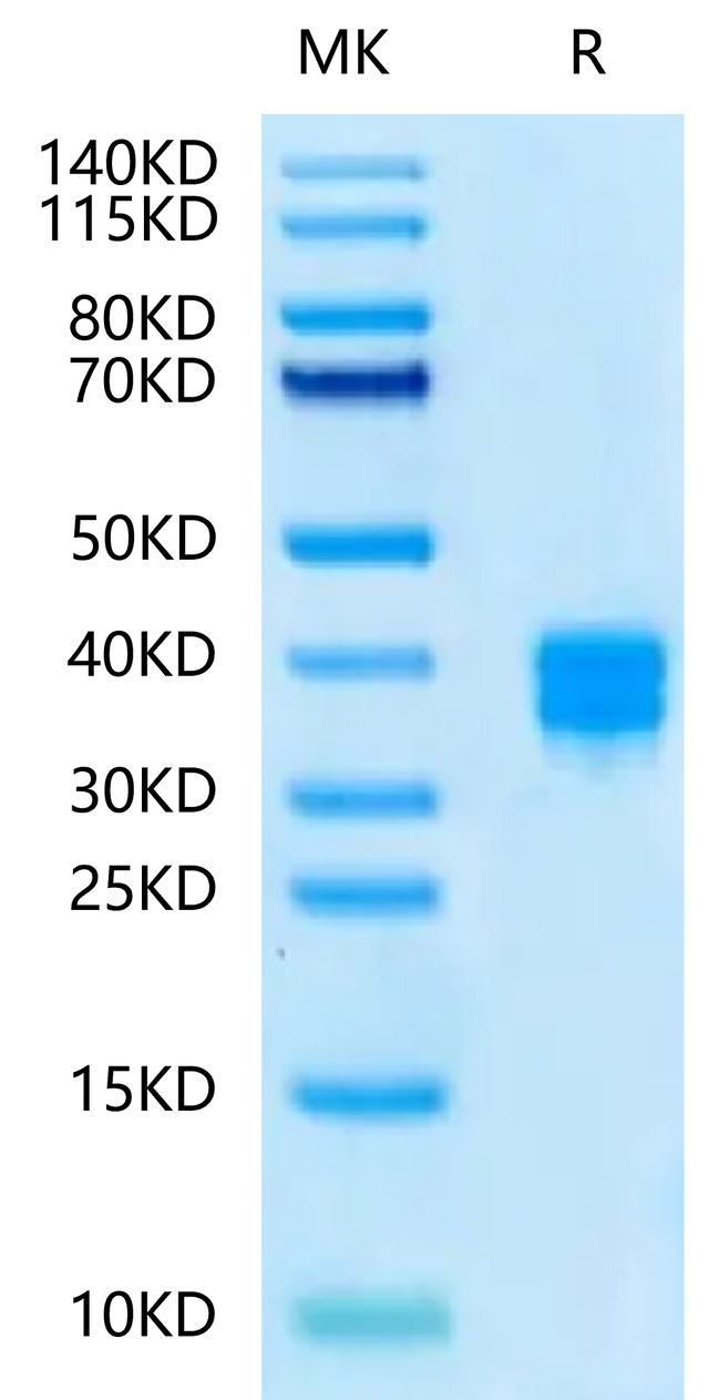 Human CD8 alpha&beta Heterodimer on Tris-Bis PAGE under reduced condition. The purity is greater than 95%.