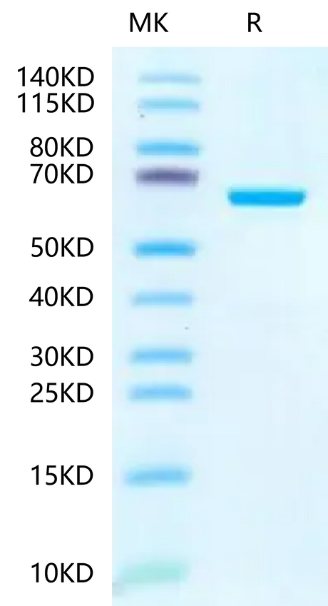 Human IGFBP-7 on Tris-Bis PAGE under reduced condition. The purity is greater than 95%.