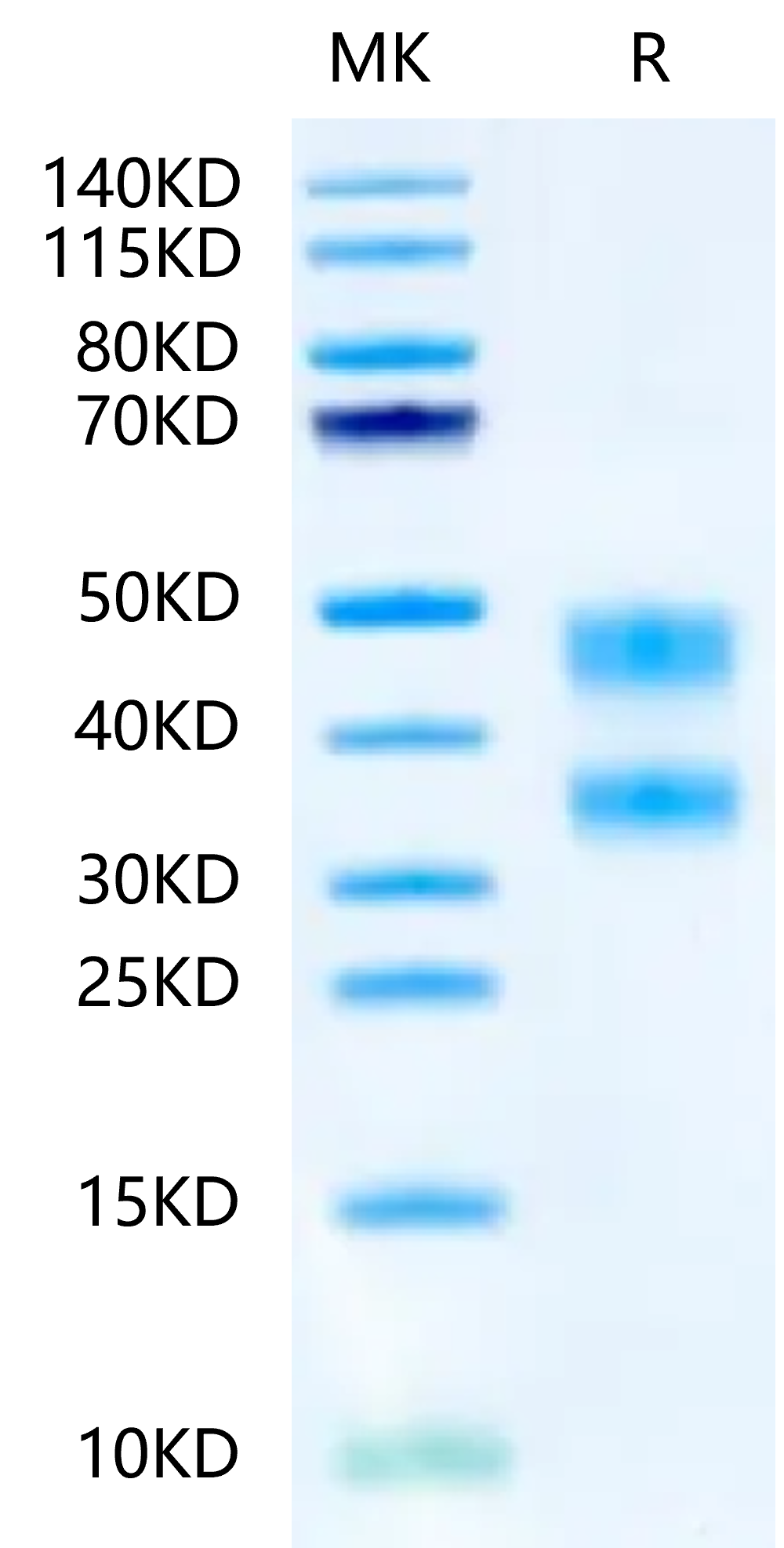 Mouse CD8 alpha&beta Heterodimer on Tris-Bis PAGE under reduced condition. The purity is greater than 95%.