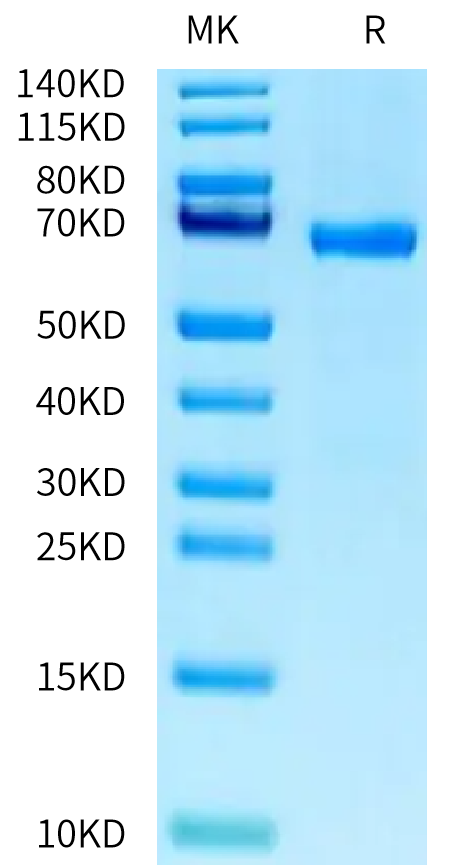 Human ABO on Tris-Bis PAGE under reduced condition. The purity is greater than 95%.