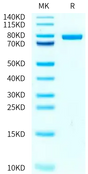 Human STAT4 on Tris-Bis PAGE under reduced condition. The purity is greater than 95%.