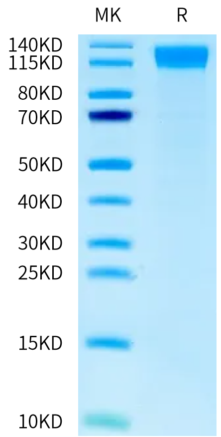 Human OSMR-GPL fusion Protein on Tris-Bis PAGE under reduced condition. The purity is greater than 95%.
