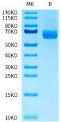 Human DLL4 on Tris-Bis PAGE under reduced condition. The purity is greater than 95%.