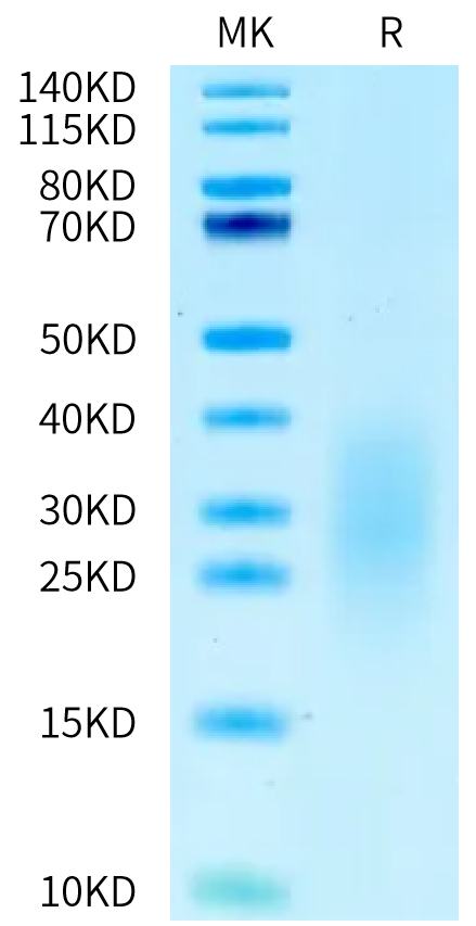 Human ALK-7 on Tris-Bis PAGE under reduced condition. The purity is greater than 95%.