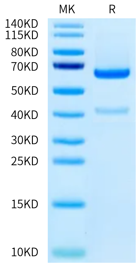 Human ADAM9 on Tris-Bis PAGE under reduced condition. The purity is greater than 90%.